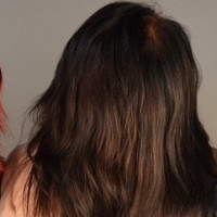 Zaujalo nás. Výskum ukazuje, že šedivenie vlasov je obranným mechanizmom buniek pred rakovinou